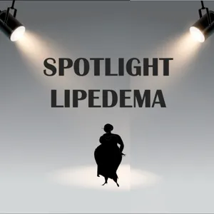 F*Lipedema! A Chat with Lipedema Blogger Carol Nogueira - Episode 9