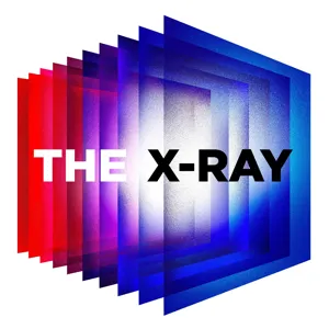 The X-Ray